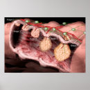 Search for large intestines posters Colon
