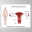 Search for female reproduction posters Gynaecology