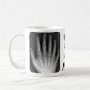 Search for xray mugs Radiology