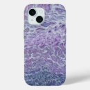 Search for foam iphone cases Abstract