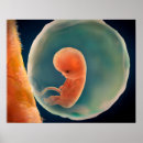 Search for foetus art Amniotic sac