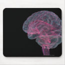 Search for human internal organ electronics Side