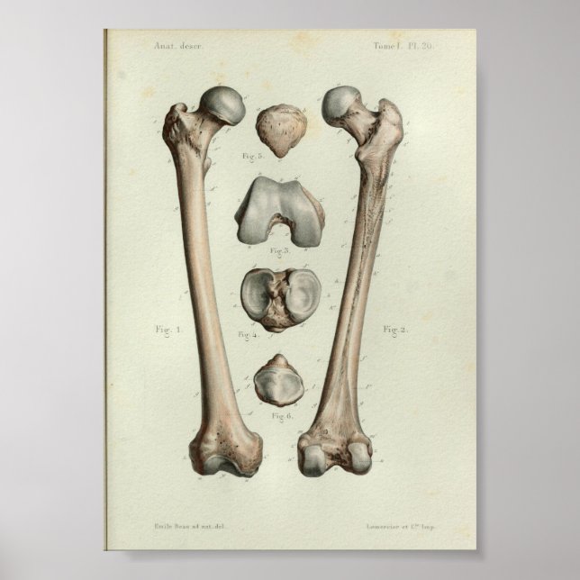 1844 Vintage Anatomy Print Femur Bone (Front)