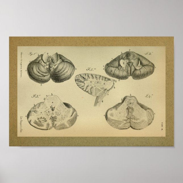 1850 Vintage Anatomy Print Brain Cerebellum (Front)