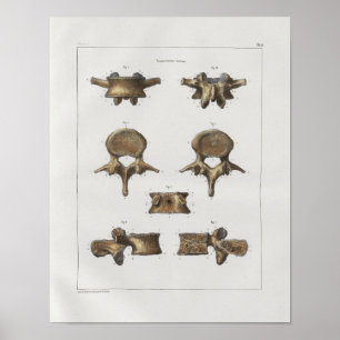 1867 Spinal Vertebrae Bones Vintage Anatomy Print
