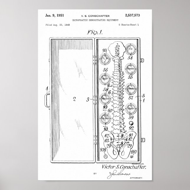 1951 Vintage Chiropractic Spine Patent Art Print (Front)