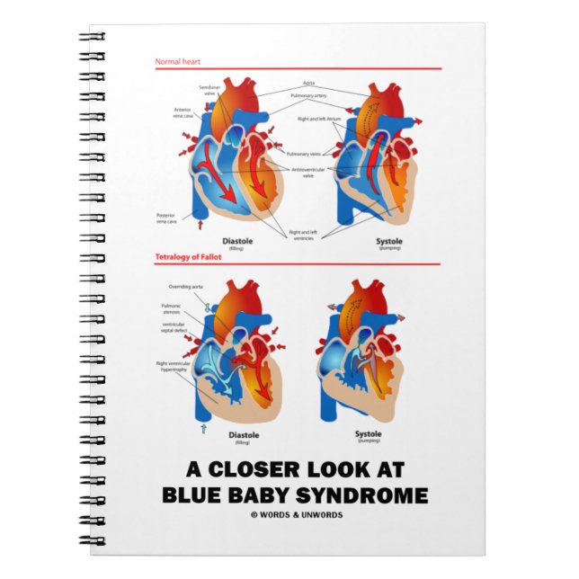 A Closer Look At Blue Baby Syndrome Heart Anatomy Notebook (Front)