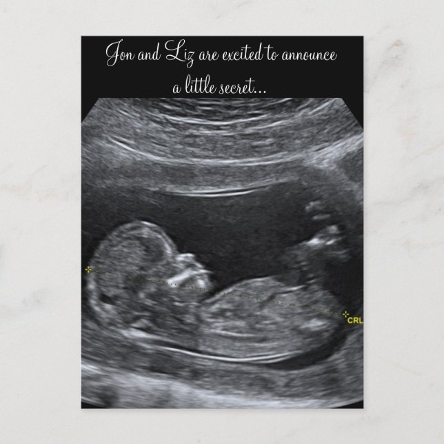 A Little Secret ~ Pregnancy Announcement Postcard (Front)