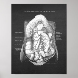Abdominal Aorta Anatomy Poster