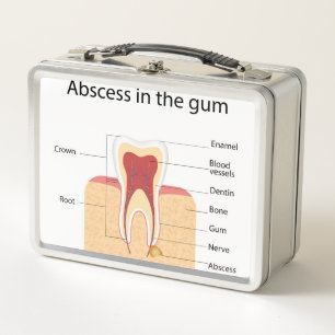 Abscess in the gum metal lunch box