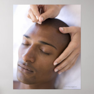 Acupuncture. Acupuncturist inserting a needle Poster