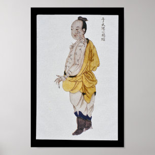 Acupuncture Small Intestine Meridian Hand Taiyang Poster