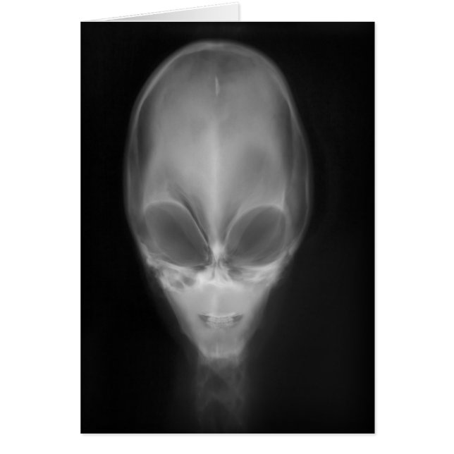 Alien Skull X-ray (Front)