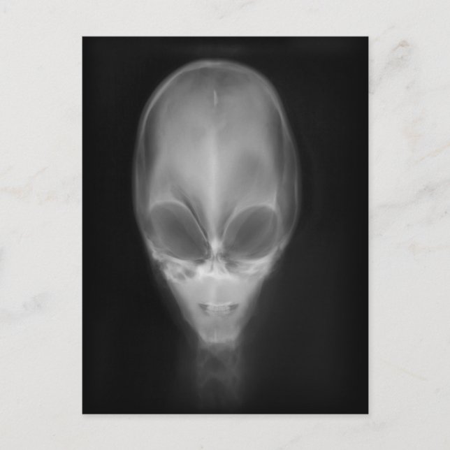 Alien Skull X-ray Postcard (Front)