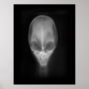 Alien Skull X-ray Poster