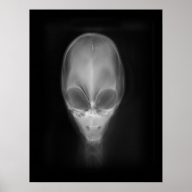 Alien Skull X-ray Poster (Front)