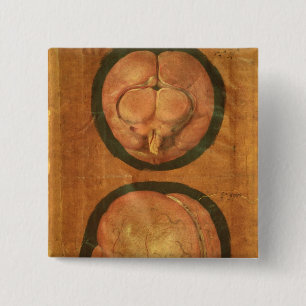 Anatomical drawing of the human brain 15 cm square badge