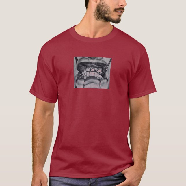 Angry Broken Teeth T-Shirt (Front)