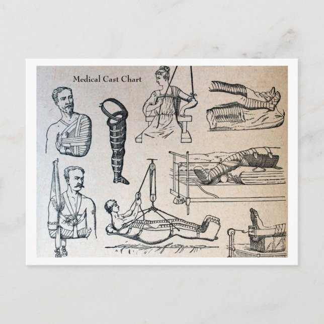 Antique Medical Casts Chart Postcard (Front)
