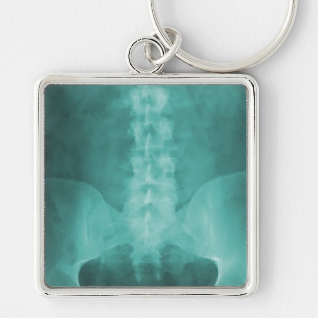 Aqua Digital X-Ray Art Keychain (Front)