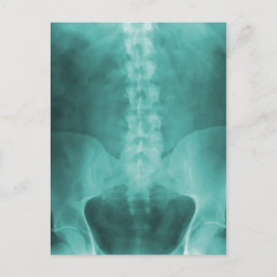 Aqua Digital X-Ray Art Postcards