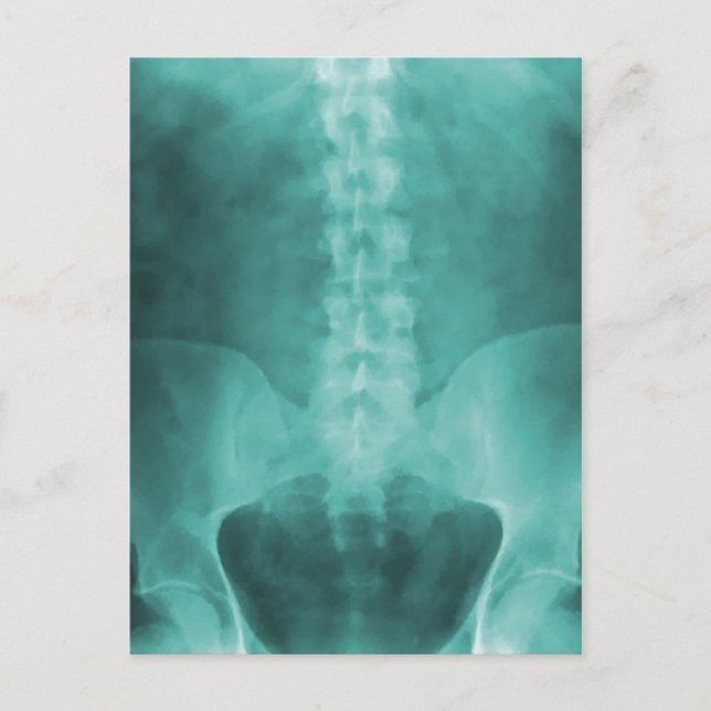 Aqua Digital X-Ray Art Postcards (Front)