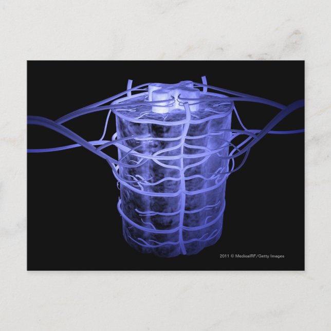 Arteries surrounding part of the spinal column postcard (Front)