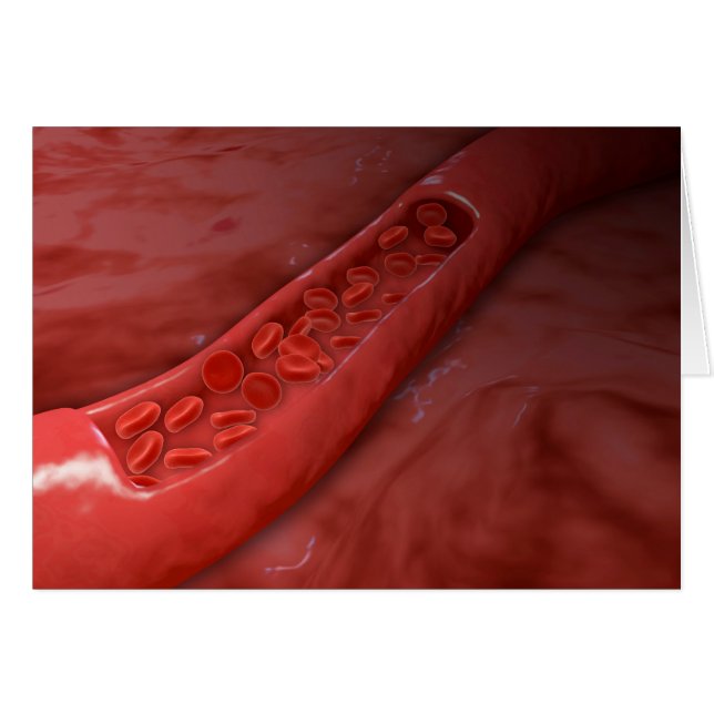 Artery Cross Section With Red Blood Cell Flow (Front Horizontal)