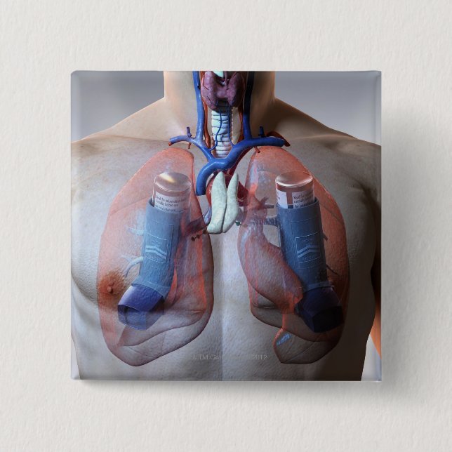 Asthma 15 Cm Square Badge (Front)