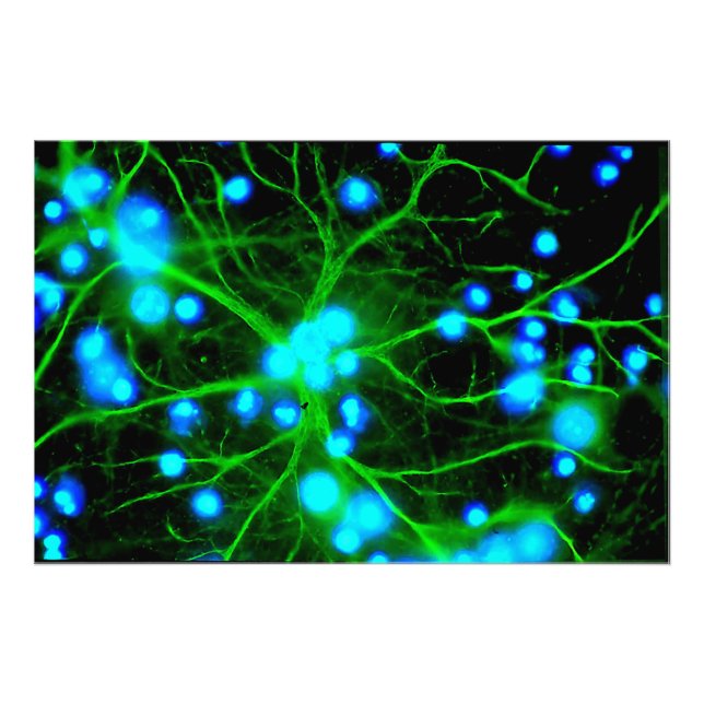 Astrocyte Are Star Shaped Glial Cells in the Brain Photo Print (Front)