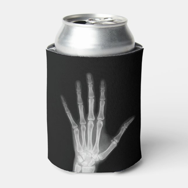 B&W X-Ray Arm Skeleton Bones Can Cooler (Can Front)