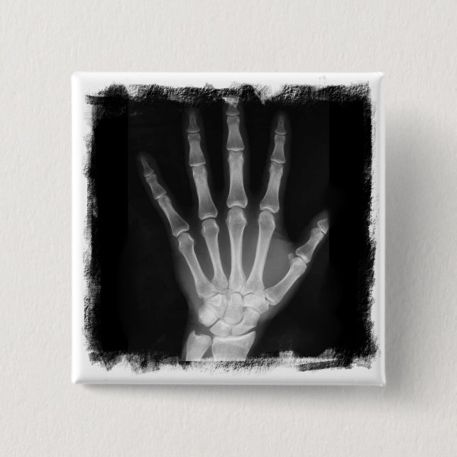 B&W X-ray Skeleton Hand 15 Cm Square Badge (Front)