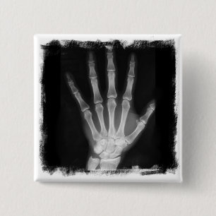 B&W X-ray Skeleton Hand 15 Cm Square Badge