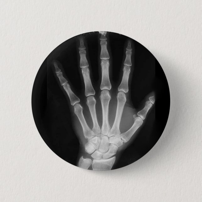 B&W X-ray Skeleton Hand 6 Cm Round Badge (Front)
