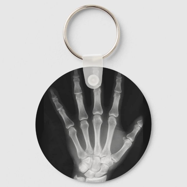 B&W X-ray Skeleton Hand Key Ring (Front)