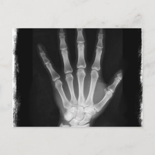 B&W X-ray Skeleton Hand Postcard
