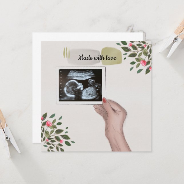 Baby Announcement Scan Picture (Front/Back In Situ)