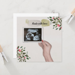 Baby Announcement Scan Picture