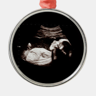 Baby Christmas Pregnancy Ultrasound Photo Classy Metal Ornament
