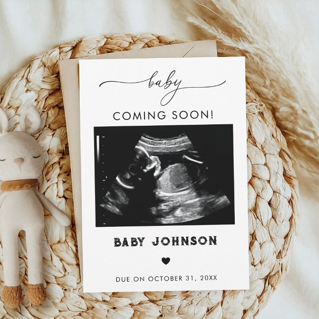 Baby Coming Soon Sonogram Pregnancy Announcement (Creator Uploaded)