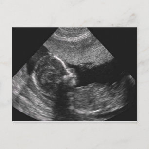 baby face,card postcard