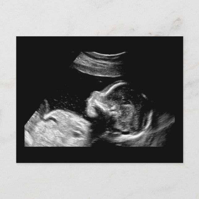 Baby Postcard (Front)