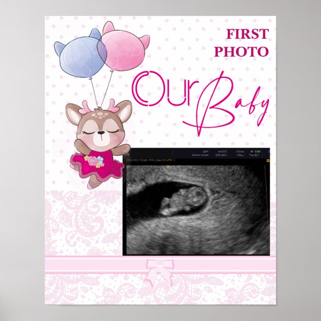 Baby Shower. Pink Baby Deer  Poster (Front)