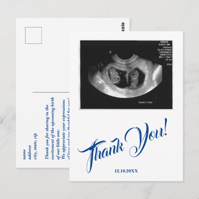 Baby Shower Ultrasound Boy Blue Thank You. Postcard (Front/Back)