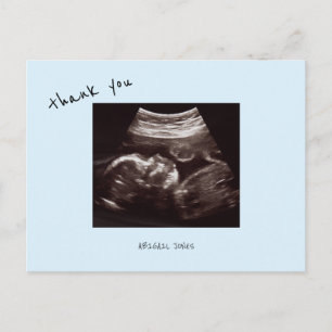 Baby Shower Ultrasound Cute Icy Blue Thank You Postcard