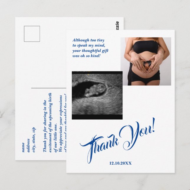 Baby Shower Ultrasound Girl Pink Thank You. Postcard (Front/Back)