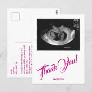 Baby Shower Ultrasound Girl Pink Thank You. Postcard