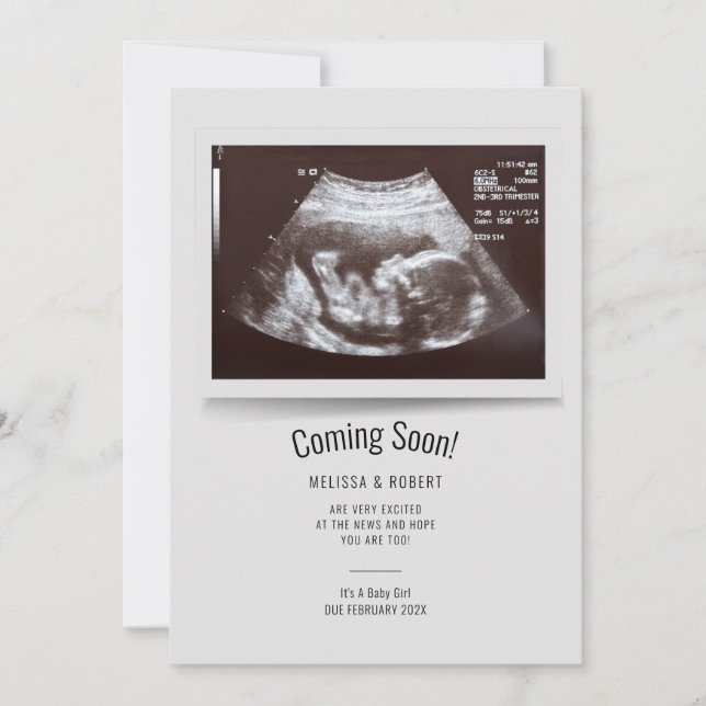 Baby Sonogram Coming Soon Pregnancy Announcement (Front)