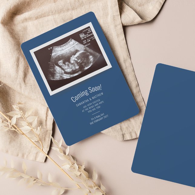 Baby Sonogram Coming Soon Pregnancy Announcement (Coming Soon Pregnancy Announcement Sonogram Photo Card)