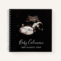 Baby Sonogram Personalised Memory Pregnancy Book